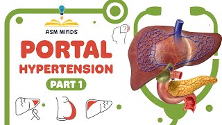 Portal Hypertension part 1 [upl. by Nnairrek]