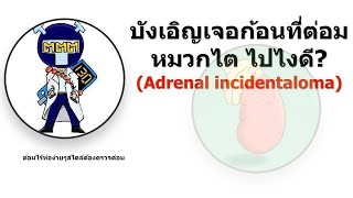 Adrenal incidentaloma [upl. by Zashin]