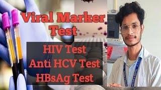 What is viral marker test how to do viral marker test HIVAIDSanti HCVHBsAg Hepatitis BampC [upl. by Liddie]