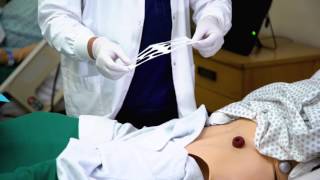 How to Change a Colostomy Bag [upl. by Hanad]