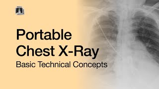 Portable Chest XRay Basic Technical Concepts [upl. by Astraea]