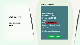 A Superior DR Progression Risk Assessment with the RETeval Device — Mitch Brigell PhD [upl. by Karole]