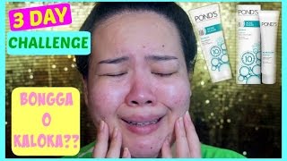 Ponds Acne Clear  3 Day Challenge on Acne Prone Skin  Bongga O Kaloka [upl. by Cyrie]