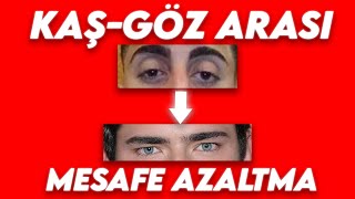 KAŞ GÖZ ARASI MESAFE NASIL AZALTILIR  GÖZ KAPAĞI GÖRÜNÜMÜ ÇÖZÜMÜ  Hunter Eyes [upl. by Matteo]