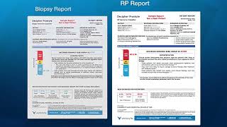 Decipher Test Report Overview [upl. by Aiynat]