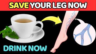 STOP YOUR KNEE PAIN 5 Teas For Your Leg Circulations  Vitality Solutions [upl. by Ariak]