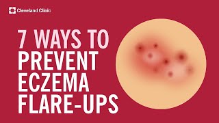 7 Ways to Prevent Eczema FlareUps [upl. by Solly]