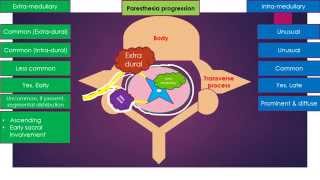 Difference between Extra medullary amp Intra medullary spinal cord lesions [upl. by Krystalle104]