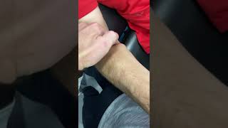 Pronator Teres muscle identification Resisted Forearm Pronation Test [upl. by Nnaik954]