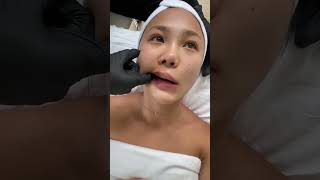 Benefits of lymphatic drainage and TMJ release facial facials facialmassage asianskincare [upl. by Htilil]