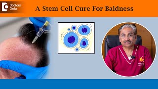 Stem Cell Treatment For Hair Loss Revolutionary Hair Therapy  DrVenkataram MysoreDoctors Circle [upl. by Rehsu]