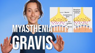 Myasthenia Gravis [upl. by Annahael]