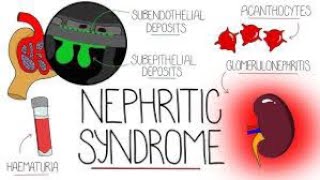 Nephritic Syndrome  Causes  Symptoms  Types  Treatment [upl. by Chandler]