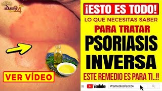 Esto es lo que Necesita Saber de la PSORIASIS INVERSA y Enterate de Estos Remedios Caseros [upl. by Byler]