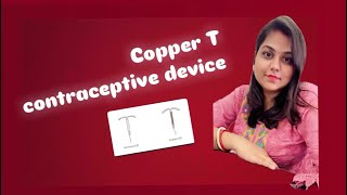 Copper T  contraceptive device [upl. by Bunker]