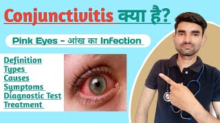 Conjunctivitis in Hindi  Causes Symptoms and Treatment of Conjunctivitis [upl. by Dulcinea]