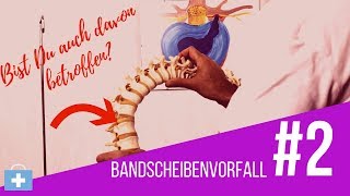 Bandscheibenvorfall😲Das passiert in Deinem Köper⚠️ [upl. by Yekcaj]