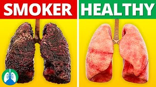 Smokers Lungs vs Healthy Lungs [upl. by Tonl135]