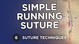 Simple Running Suture  Learn Suture Techniques [upl. by Aierdna]