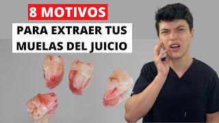 🦷 ¿CUANDO SE RECOMIENDA EXTRAER LAS MUELAS DEL JUICIO CORDALES TERCERAS MOLARES Y QUIEN LO HACE [upl. by Ordway790]