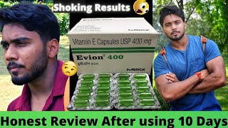 Evion 400 Capsules Honest Review after using 10 Days  Uses Benefits Side Effects [upl. by Valina]