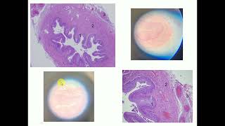 Histology slide identification Ureter  By Dr Mitesh Dave [upl. by Anorahs]