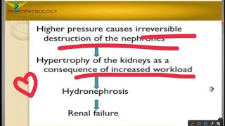 Hydronephrosis [upl. by Nennarb]