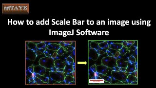 How to add Scale Bar to an image using ImageJ Software [upl. by Navets]