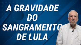 Governadores se unem contra retirada de seus poderes  Alexandre Garcia [upl. by Devlen552]