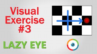 Lazy Eye Exercise 03 [upl. by Ainotal]