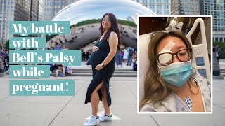 My Sudden Bells Palsy Diagnosis while Pregnant at 40  Chef Julie Yoon [upl. by Vidovik563]