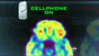 Cell Phones Mysterious Effects on the Brain 2222011 [upl. by Martyn886]