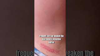 Watch This Before Using Hair Removal Creams ⚠️Dermatology Tips [upl. by Sedgewick]