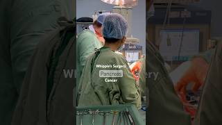 Whipple’s Surgery for Pancreas Cancer [upl. by Anieral388]