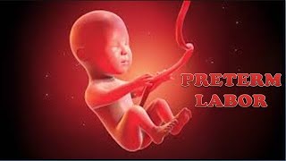 PRETERM LABOR  Define Causes Pathophysiology Diagnosis amp Management  Preterm Labor TOCOLYTICS [upl. by Enohpets]