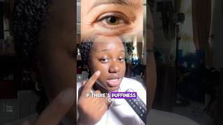 Are your under eyes dark Swollen Or wrinkled Just follow the instructions in this video💯 [upl. by Josephson14]