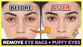 ✨ REMOVE UNDER EYE BAGS PUFFY EYES SWOLLEN EYES PERMANENTLY  GET BRIGHT EYES amp BEAUTIFUL EYES [upl. by Torruella948]