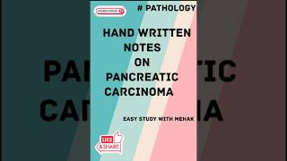 Handwritten notes on pancreatic carcinoma [upl. by Pillyhp]