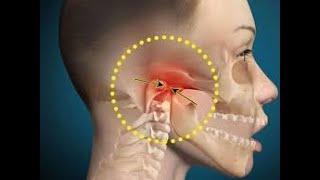 Part 2 Biomechanics of TMJ From normal physiology to disc Disorder [upl. by Favianus716]