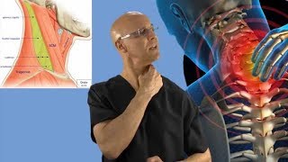 90Second Relief Technique for a Stiff Neck Wry Neck Torticollis  khabar station [upl. by Noivad330]