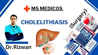 CholelithiasisSurgeryMS MedicosDr RizwanUrdu Hindi Easy Explanations [upl. by Cheung]