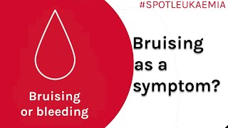 Bruising Symptom Spotlight  Spot Leukaemia [upl. by Kast]