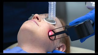 How does fractional CO2 laser resurfacing erase signs of aging [upl. by Miles649]