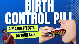 4 MAJOR Effects of Birth Contrl Pills On Your Skin [upl. by Onig100]