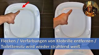 Flecken  Verfärbungen von Klobrille entfernen  Toilettensitz wird wieder strahlend weiß [upl. by Madonia]