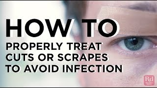 How to Properly Treat Cuts or Scrapes to Avoid Infection [upl. by Nemra]