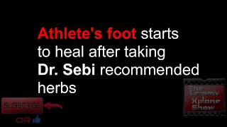 Athletes foot heals after taking these herbs recommended by Dr Sebi [upl. by Auop]