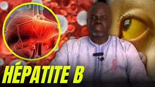 Hépatite B 1   Causes et Conséquences   Pr Ousmane Ndiaye  SAMA XALAAT TV [upl. by Rimola955]