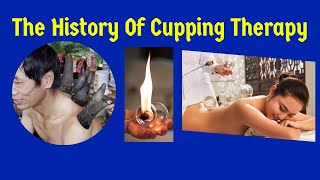 The History of Cupping Therapy An Ancient Healing Practice [upl. by Nivalc]