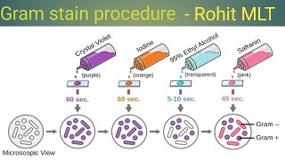 Gram stain procedure gram staining steps gram positive and gram negative [upl. by Pritchett]